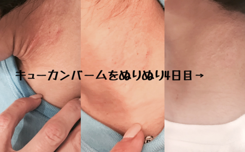 cucumbalm face&body バーム